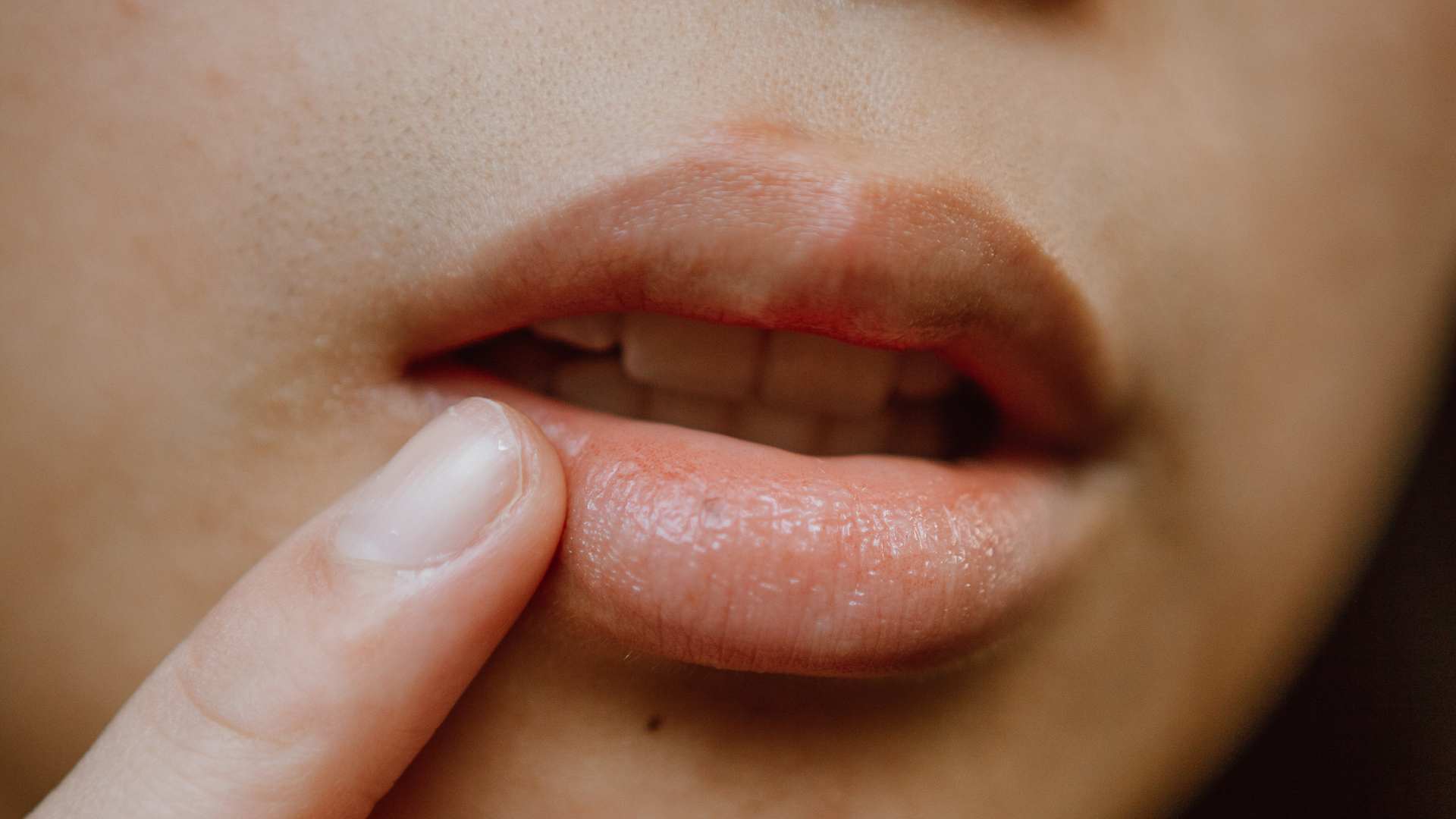 Por Qué Se Resecan Los Labios Y Cómo Prevenirlo